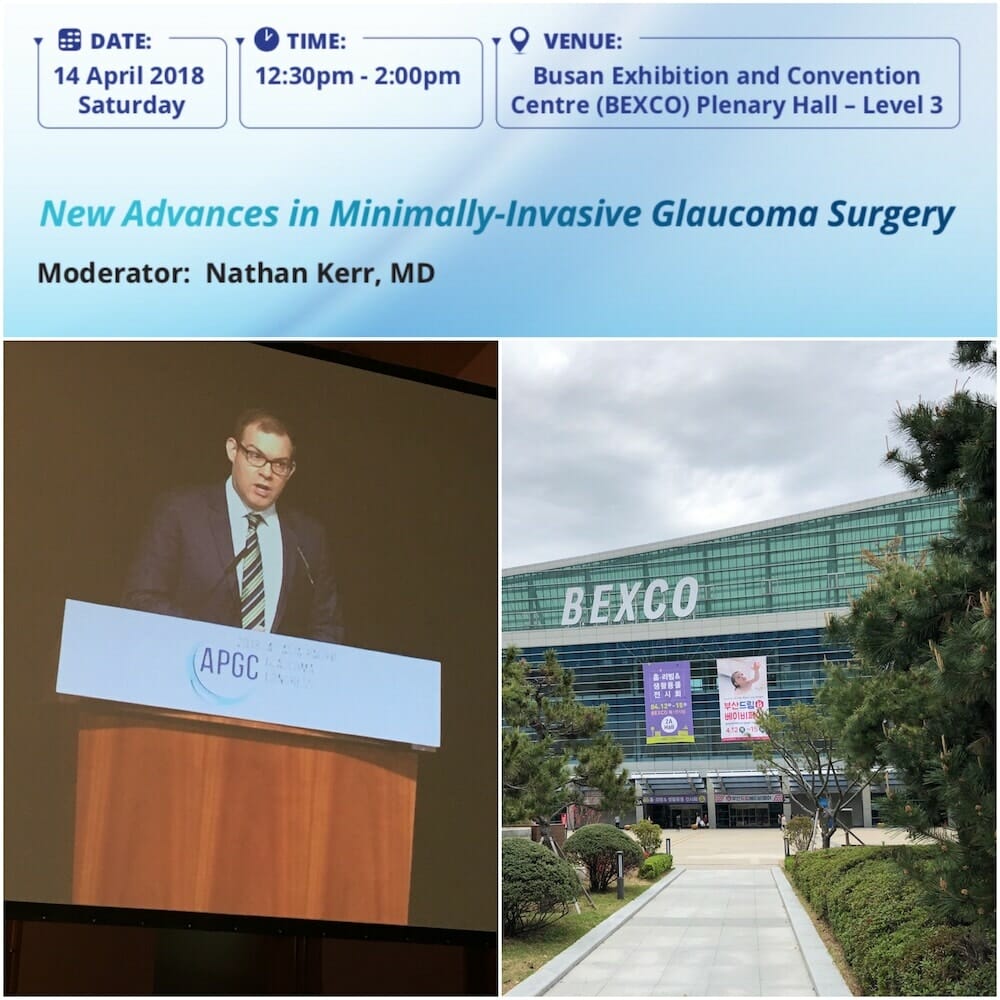 A New Era in Glaucoma Surgery with Supraciliary Stenting