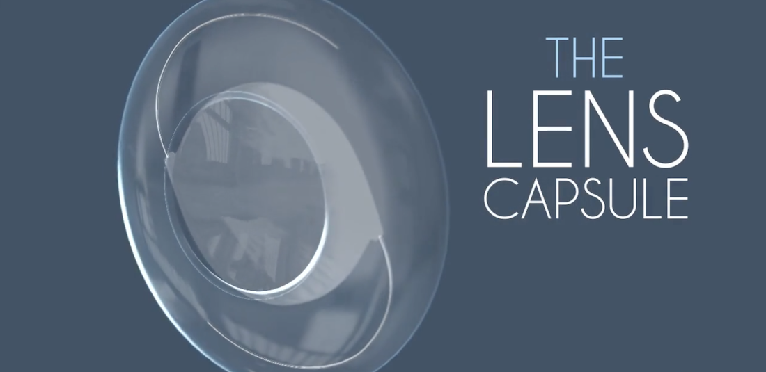 Diagram of the lens capsule